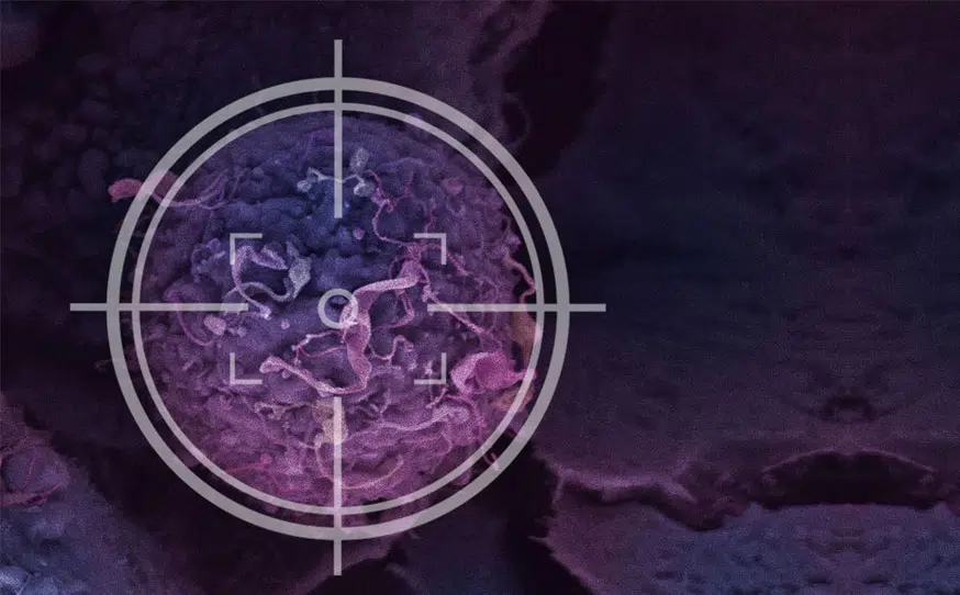 Illustration montrant Les therapeutiques ciblees en traitement du cancer du sein institut du sein paris