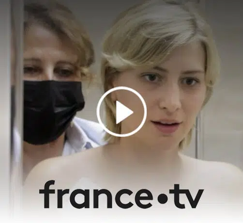 Photo de maeva decouvrant sa poitrine apres une reconstruction mammaire institut du sein paris