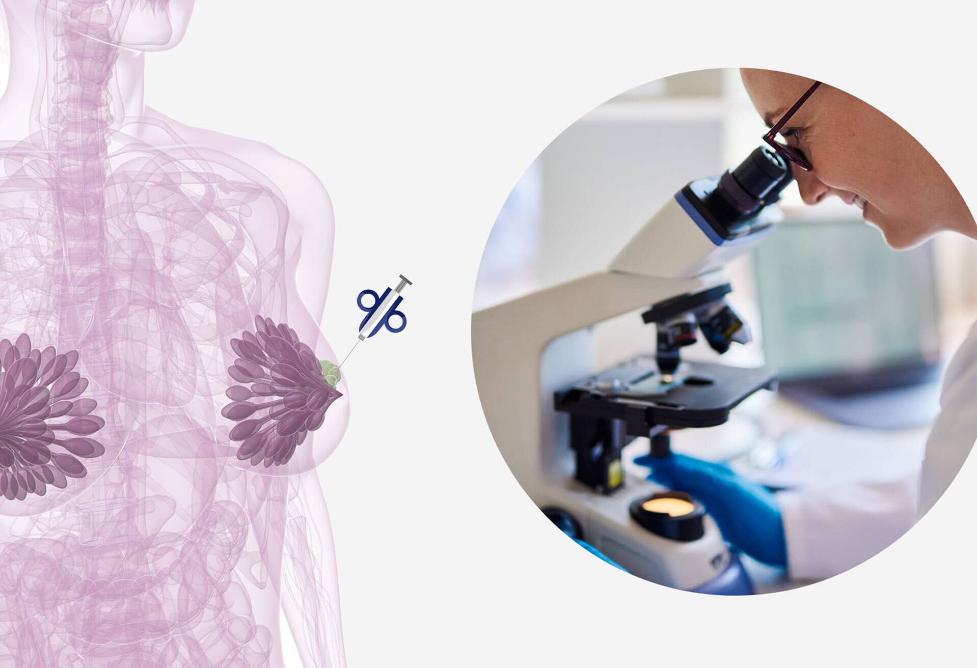 Biopsie sein | Diagnostic cancer du sein | L'Institut Du Sein Paris