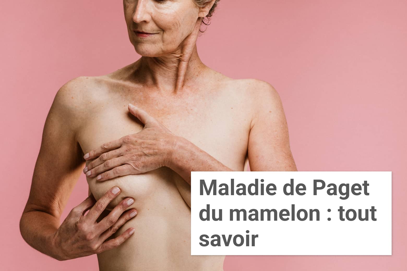 Maladie de Paget du mamelon: tout savoir | Paris| Institut du sein
