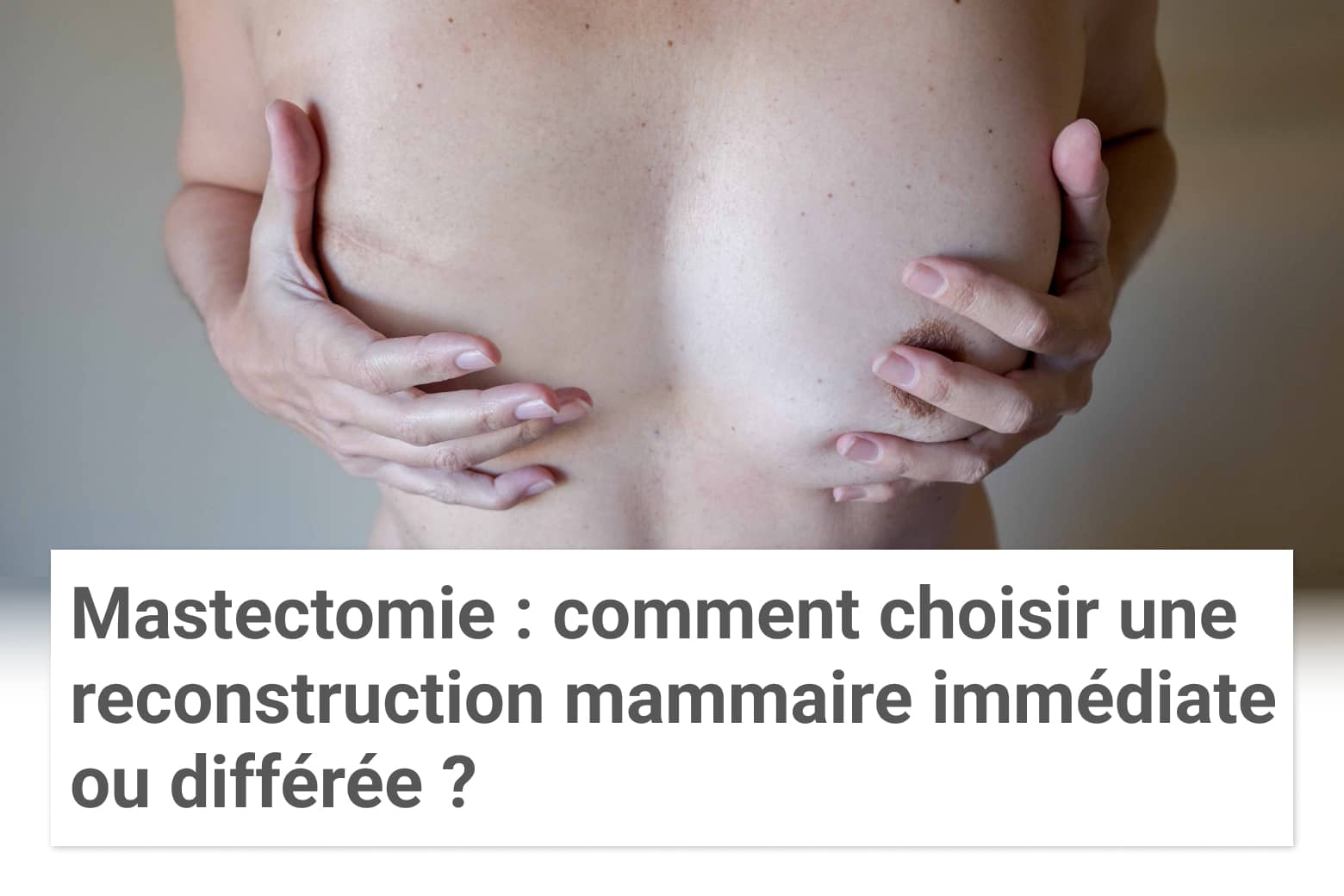 Mastectomie : comment choisir entre une reconstruction mammaire immédiate ou différée ?| Paris| Institut du sein