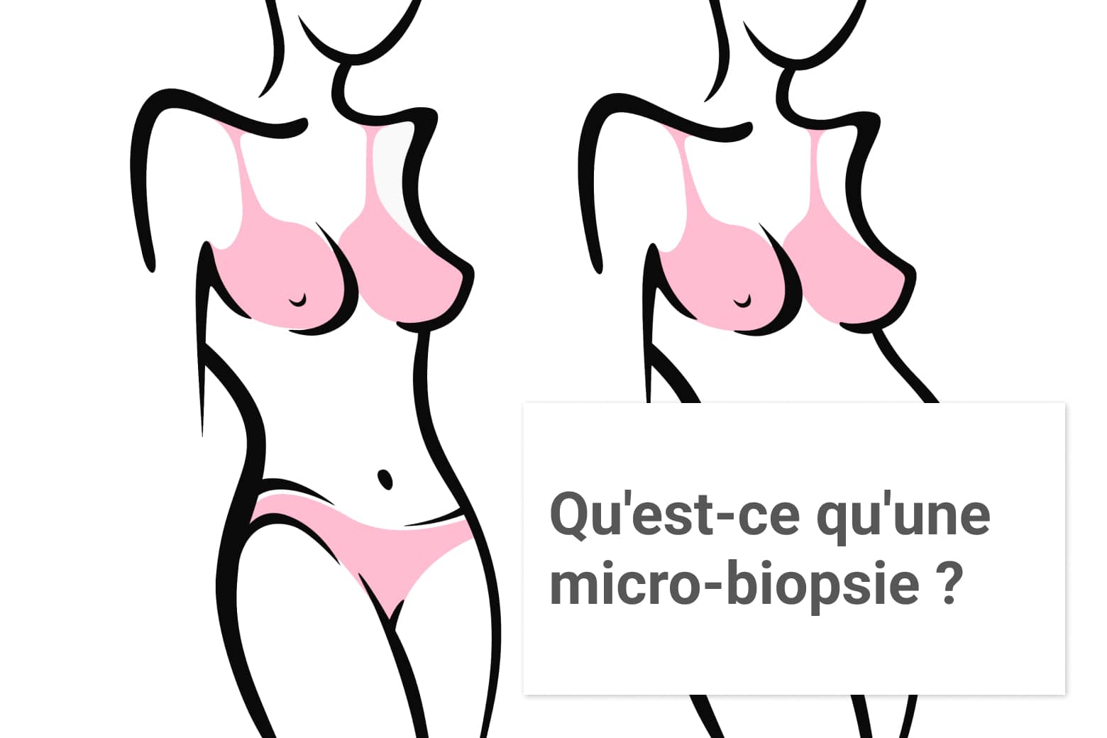 Qu'est-ce qu'une microbiopsie du sein ? | Paris| Institut du sein