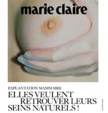 Article de la presse ecrite MARIE CLAIRE Explantation mammaire elle veulent retrouver leurs seins naturels institut du sein paris