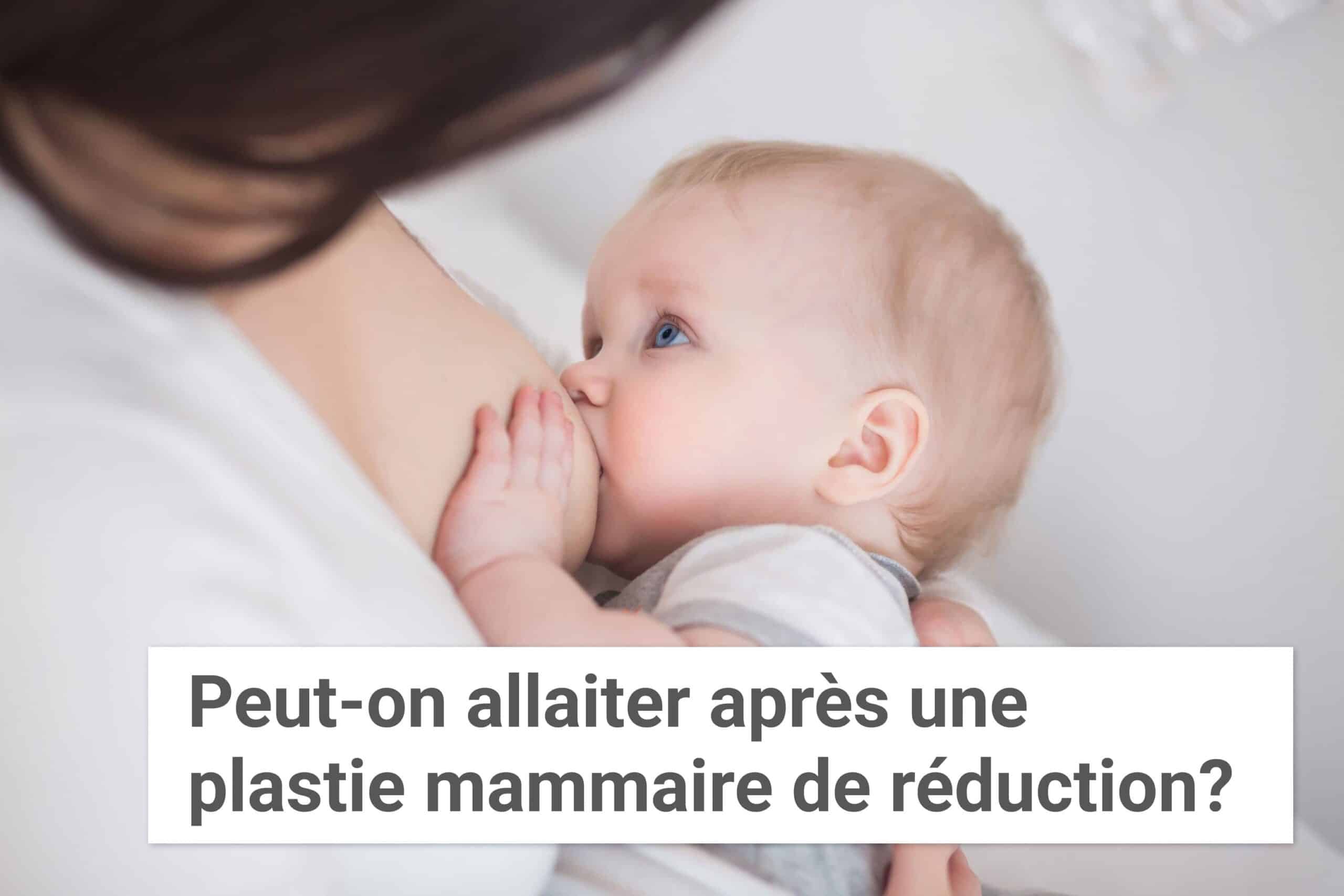 Allaitement après réduction mammaire : possible ? | Institut du Sein | Paris