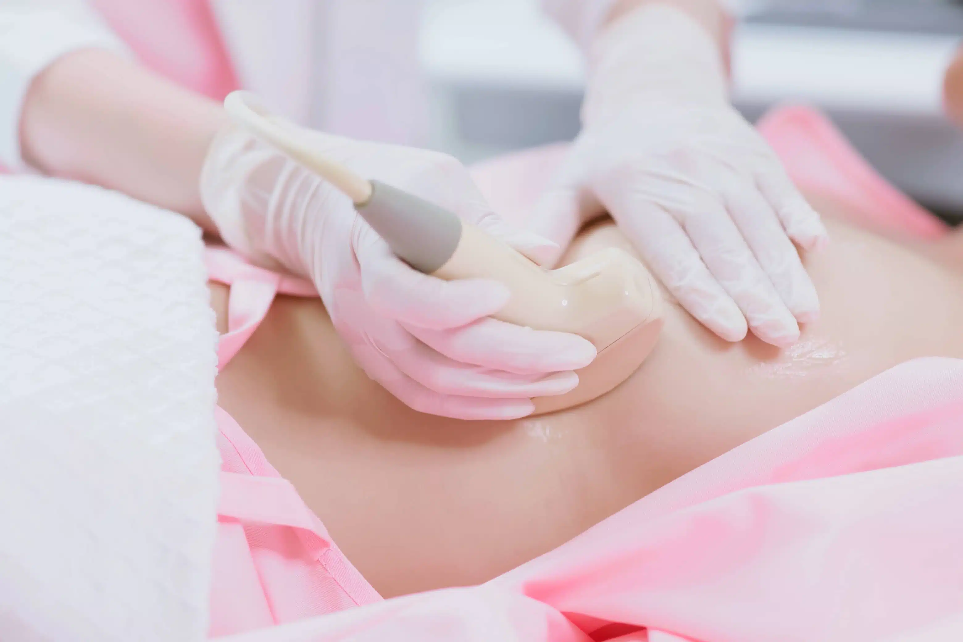 Qu’est-ce que la cryoablation ? | Institut du Sein | Paris