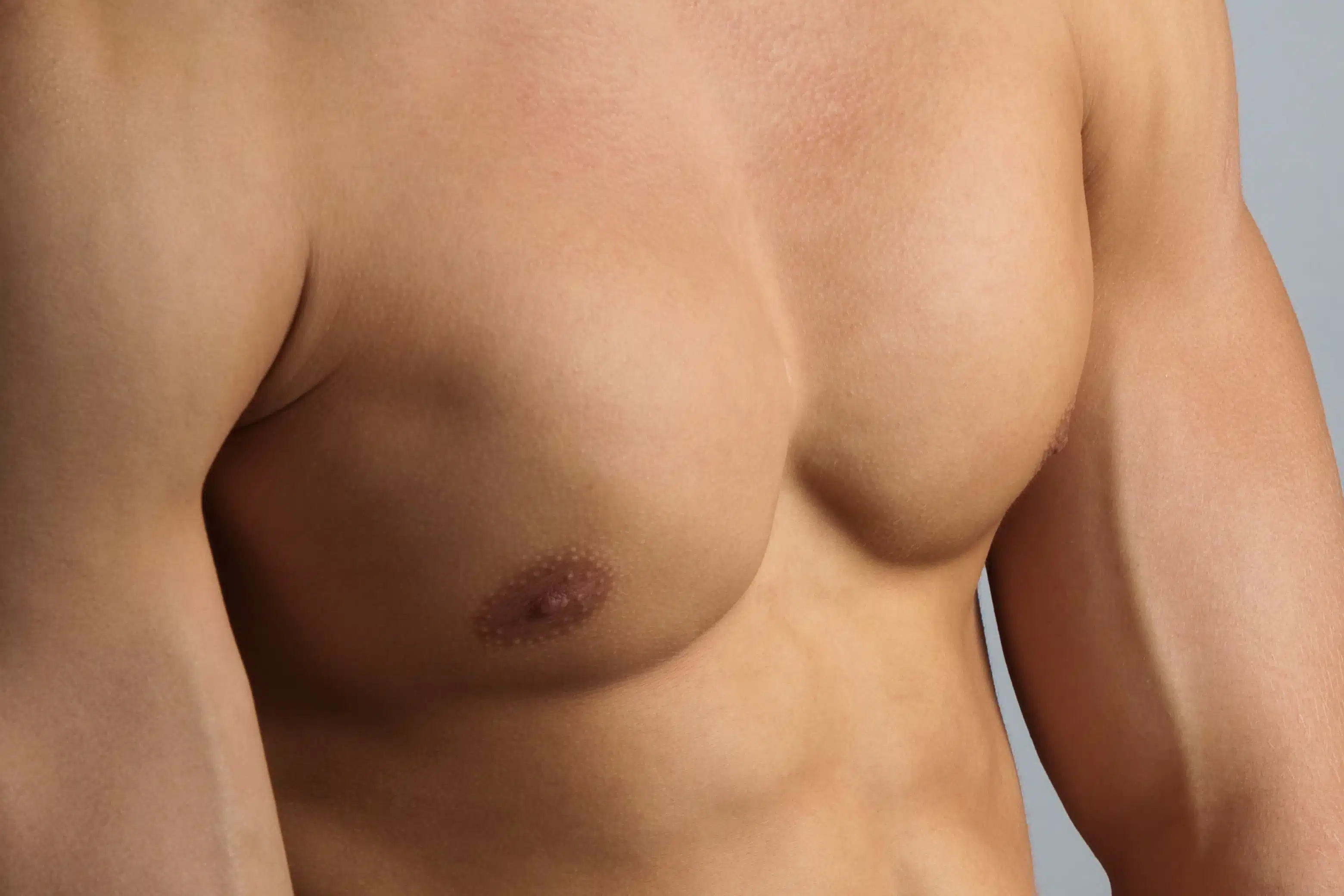 Chirurgie pour gynécomastie