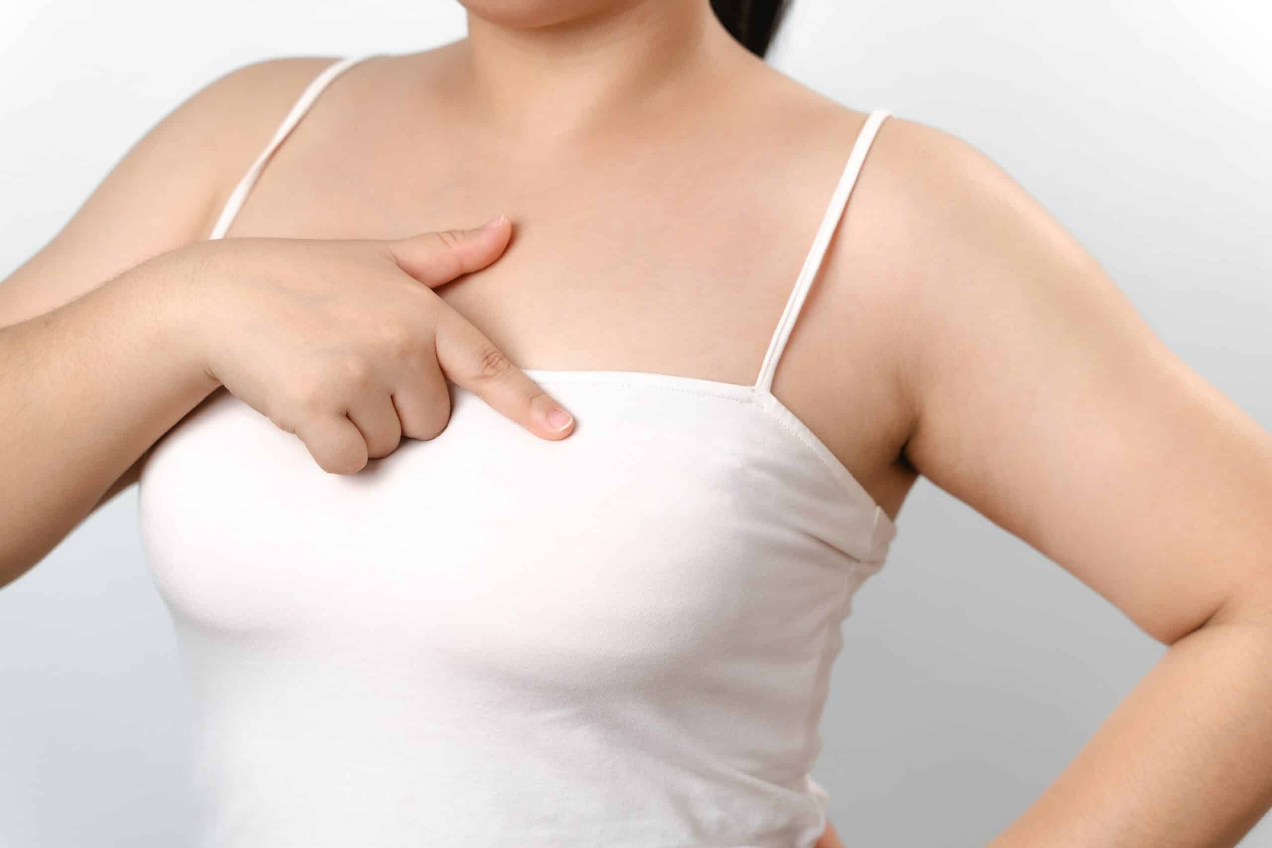 Réduction mammaire en cas d’hypertrophie