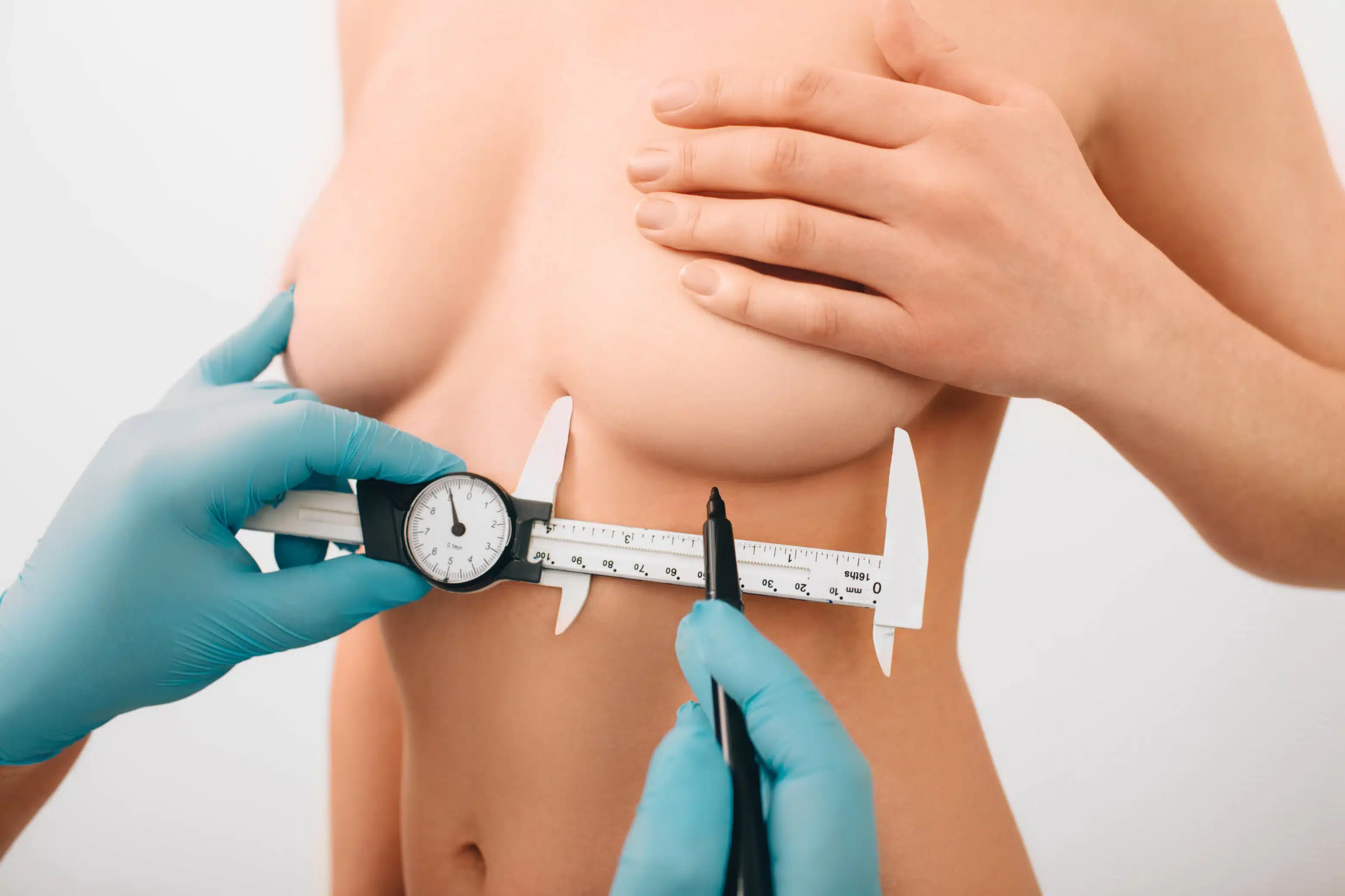 Prix d’une augmentation mammaire